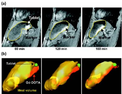 Figure  I-26:  Extrait  de  [104] :  Visualisation  de  la  position  du  comprimé    dans  l’estomac,  (a)  clichés IRM en coupes sagittales avec acquisition T1 de l’estomac à t = 60 ; 120 et 180 minutes  et (b) reconstruction 3D de la dynamique intra-gas