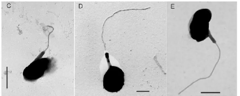 Figure I-9: Images en microscopie électronique à transmission de trois souches distinctes de  l’espèces  Micromonas pusilla