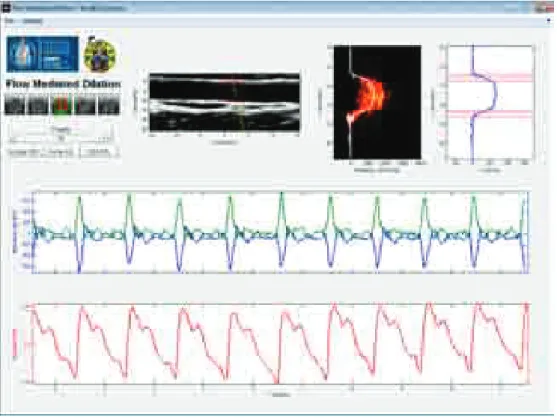 Figure 2.6: The SPP interface for FMD application.