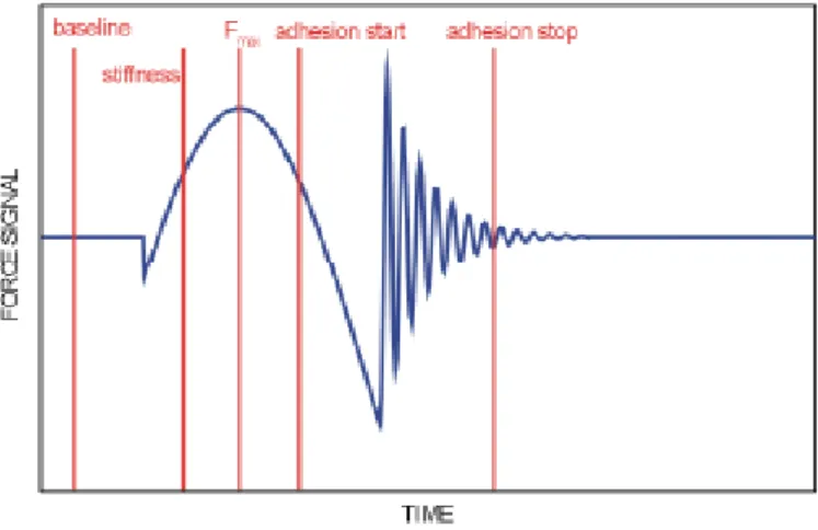Figure 2-4: Schéma de principe du positionnement des différents triggers par rapport au signal de déflexion.[4] 