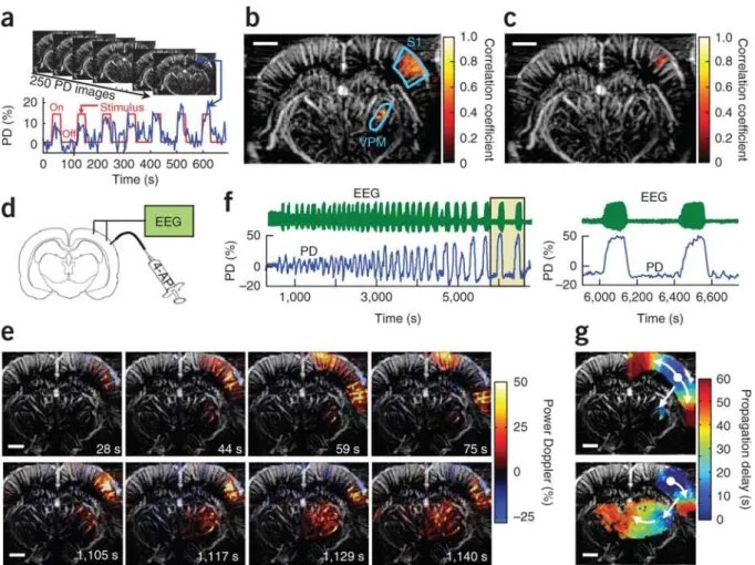 Figure I-6 : Première preuve de concept de l’imagerie fonctionnelle cérébrale par ultrasons (fUS) chez  un rat anesthésié (figure extraite de l’article Macé et al