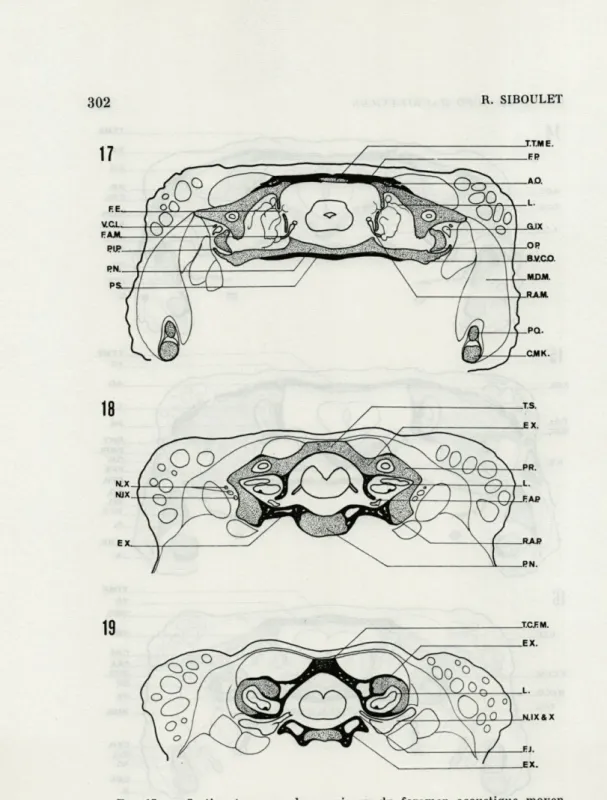 FIG.  17.   —   Section  transversale  au  niveau  du  foramen  acoustique  moyen. 