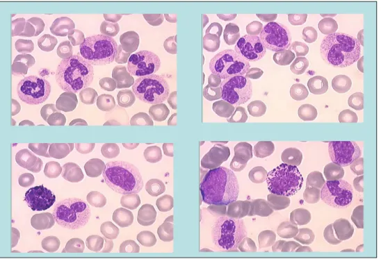 Figure 1: Aspect du frottis sanguin, coloré au May Grunwald Giemsa 