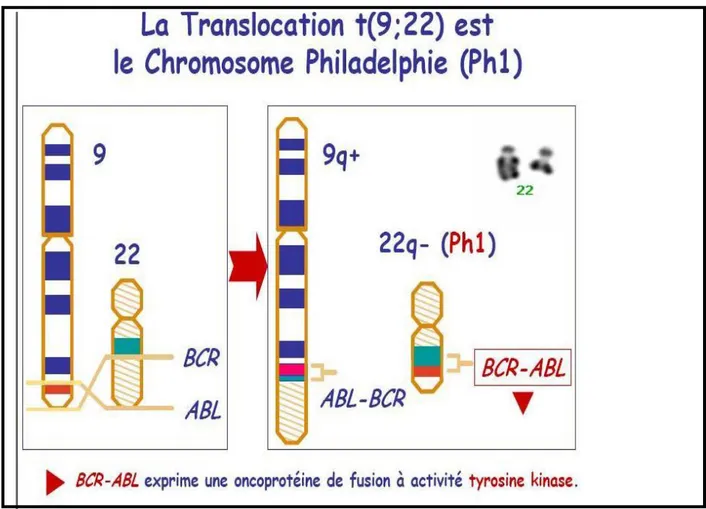 Figure 4 : Mécanismes de formation classique du chromosome  Philadelphie (chromosome 22 court) [Dr Franck Nicolini  groupe Fi(φ)-LMC] 