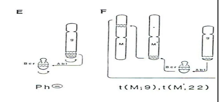 Figure 7 : Mécanisme de formation du gène BCR-ABL dans les  translocations complexes dans la LMC