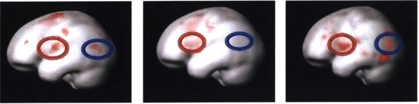 Figure 7-3 Activation of  the left temporo-parietal cortex while preforming  reading tasks