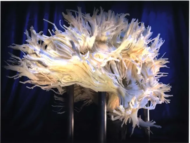 Figure 7-7  3D  model of the white matter pathways in the brain