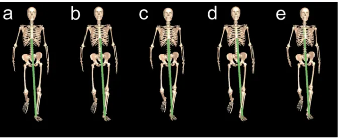 Figure 2.27  Simulation de la marche normale d'un sujet portant une prothèse osseuse- osseuse-articulaire [69]