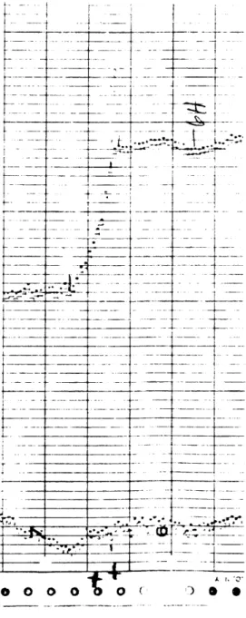 Fig.  6  Telepsychrometer  trace at  LKC