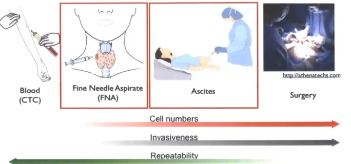 Figure  1-  1.  Potential  sources of cancer cells in  clinical samples;  circulating  tumor  cells (CTCs),  fine needle aspirates  (FNA),  ascites, and surgery