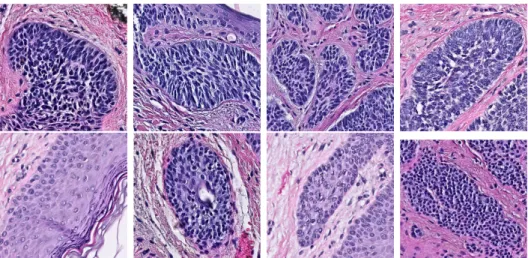 Figure 1-1: The visual features that differentiate BCC from other biological struc- struc-tures can be subtle, such as the size of the cells (blue dots in the images)