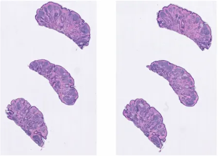 Figure 2-1: A whole slide image that contains two collections of pieces of skin, each collection having three pieces of skin