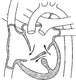 Figure 4 La communication auriculo-ventriculaire 