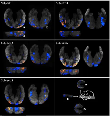 Figure 4: Gini contrasts for all 8 classes, shown in 3D at their positions on the cortex