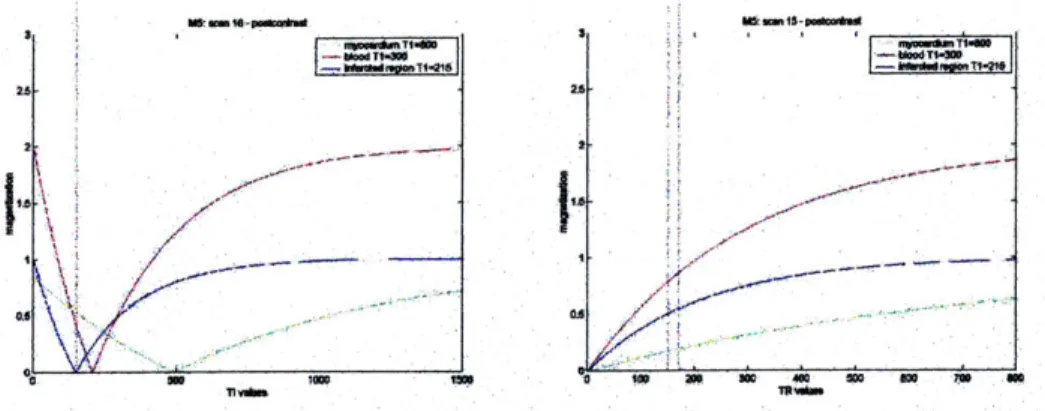 Fig 3.3  :  Inversion Recovery  curves  (Left), Saturation  Recovery Curves (Right).