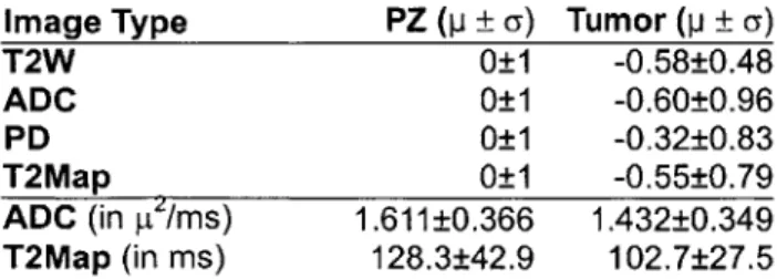 Table  1  Signal  intensity summary  for  11  non-brachytherapy  patients.  PZ  signals  are standardized  to  0 mean  and  I  std dev