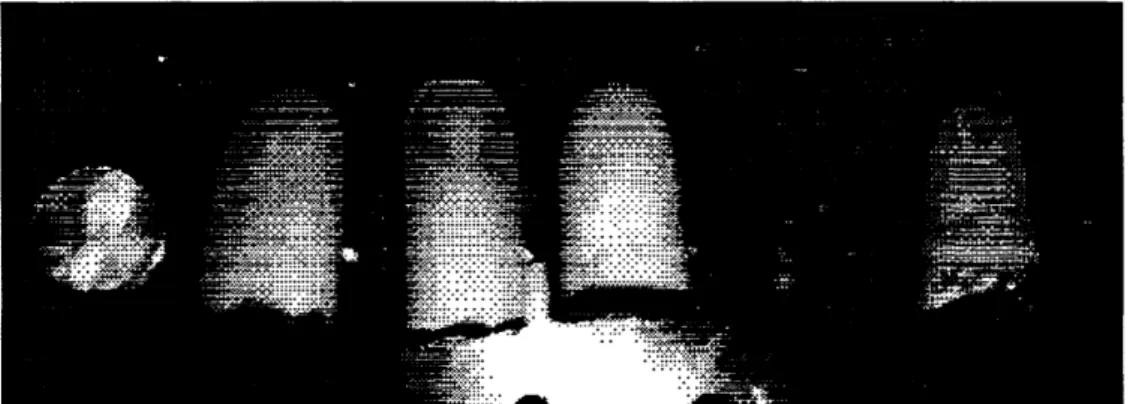 Figure 6-1:  Photograph  of a penny  and the  5  epoxy fingertip  replicas.