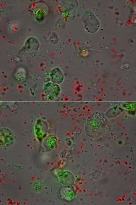 Figure 3.  Efficient Internalization. Microscopy confirms the internalization of antibody-opsonized beads (green), while non-opsonized beads remain in solution (63x magnification).