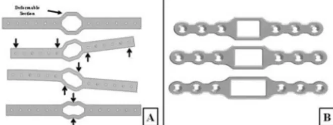 Figure 1: (A) Concept for an adjustable bone plate showing various  