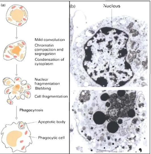 Figure 2 : Représentation schématique et micrographie d'une  cellule en  apoptose  (Molecular  Cell  biology,  Fourth  ed.,  Lodish  et  al.,  WH Freeman 2000)