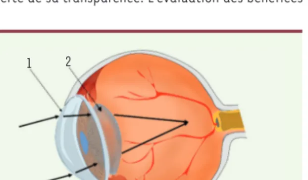 Figure 1. Le globe oculaire focalise l’image (flèches noires pleines)  sur son capteur, la rétine, à l’aide de deux lentilles convergentes  disposées en série : la cornée (1) puis le cristallin (2).