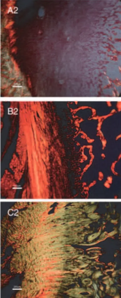Figure  26:  Organisation  des  fibres  de  collagène  l  en  fonction  de  l’âge.  Rouge  sirius  et  microscopie  en  lumière  polarisée