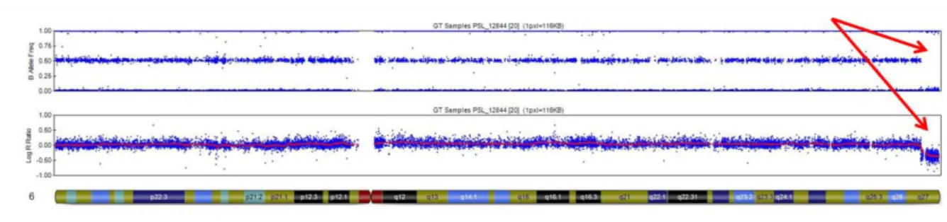 Figure 15 : délétion terminale 6q de 3,5Mb (patient PSL_12844). Il n'y a plus de SNP avec BAF  à 0,5 (LOH), et le LRR est négatif 