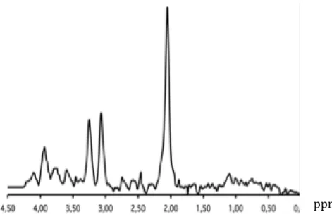 Figure 3 : tracé de spectroscopie 