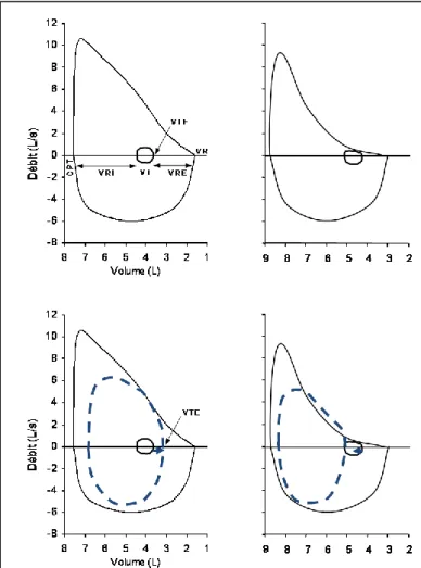 Figure  3  :  Comparaison  des  courbes  débit-volume  forcée  et  spontanée  au  repos (en trait plein) avec la  courbe débit-volume  spontanée au cours d’un  exercice  musculaire  sous-maximal  (trait  pointillé),  chez  un  sujet  normal  (gauche)  et  