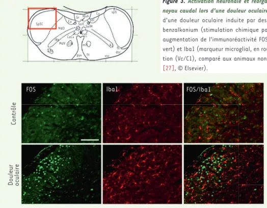 Figure 3. Activation neuronale et réorganisation de la microglie dans le sous- sous-noyau caudal lors d’une douleur oculaire