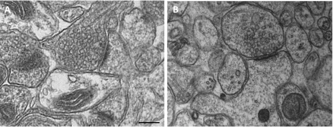 Figure  6  :  Comparaison  de  la  morphologie  de  synapses  excitatrices  d’hippo a pe  ap s  fi atio   chimique  et  après CHP 