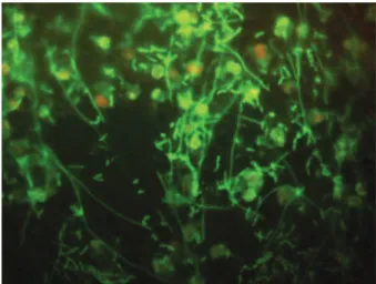 Fig.  2.  Epifluorescence  microphotopgraph  of  bacteria  hybridized  with  EUB338  oligonucleotide probe (yellow) in a phytoflagellate culture