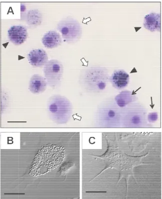 Figure  2.  Microphotograp Crassostrea  rhizophorae  a type souche (« blast-like ce par  des  flèches  blanches,  e Rebelo  et  al.,  2013) ;  (B)  contraste d’interférence dif 10 µm