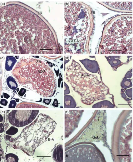Figure 9. Atretic follicles in Trachurus murphyi ovaries. (a) = non atretic oocyte, (b) A1-A 