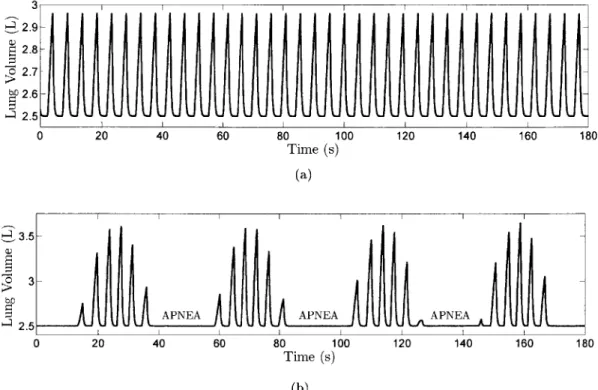 Figure  1.1:  Computer-simulated  lung  volume  waveforms  in  (a)  stable  and  (b)  unstable  breath- breath-ing  caused  by  prolonged  blood  transport  delay  and  elevated  chemoreflex  gain