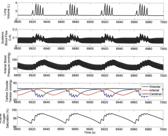 Figure  2.3:  PNEUMA-simulated  waveforms  representing  CSA.