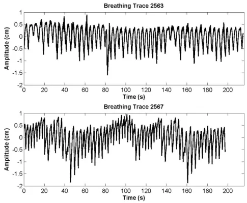 Figure 3-2: Breathing traces 2563 (displayed using a scale factor of 3) and 2567 (displayed using a scale factor of 2)