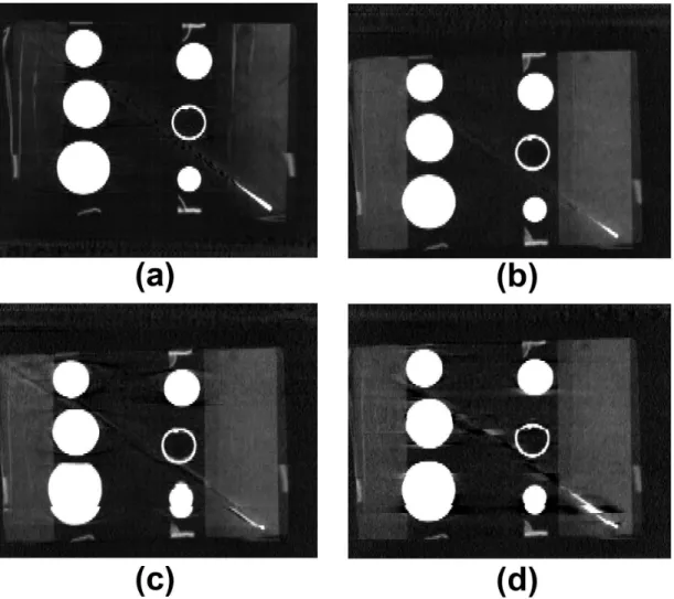 Figure 4-5: Using the Philips scanner, (a) coronal slice of static phantom; coronal slice of phantom at 0% (inhale) phase for (b) 2 cm sine, (c) 2563 trace, (d) 2567 trace.