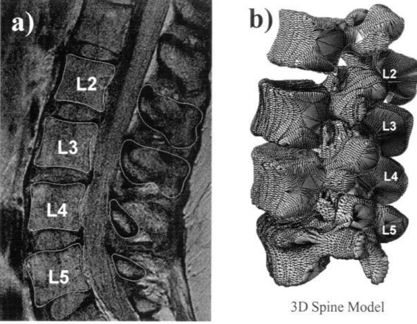 Figure  2-2:  a)  Contours  of  the  vertebrae  bodies  was  digitized  with  spline  curves  give  the  anatomy information of the lumbar spine