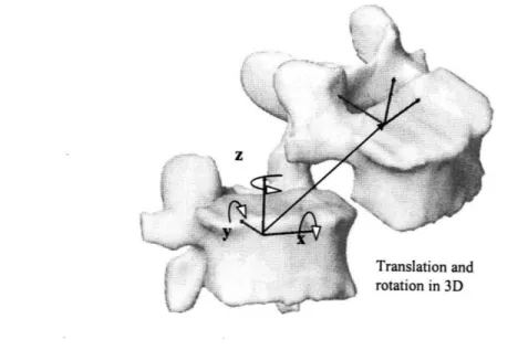 Figure 2-8:  Coordinate system to describe 6DOF spine kinematics,  both translational and rotational.