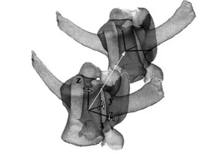Figure 3-1:  A demonstration of  local  coordinate  system  established  to  determine 6DOF kinematics  of the  ovine  lumbar spine.