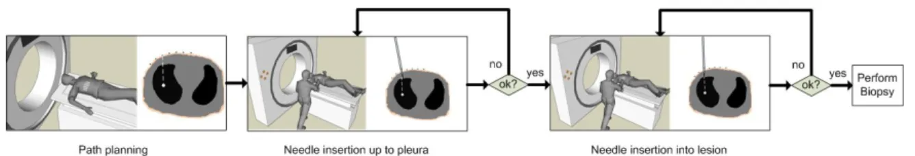 Figure 1. Workﬂow of a needle biopsy in the lung. First, the trajectory is planned with the help of a radio-opaque grid aﬃxed to the skin of the patient