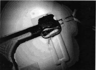 Figure  8 Zebrafish  trapped  in the immobilization  chamber of chip design  in figure  7