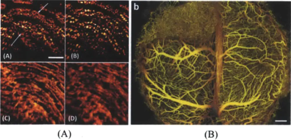 Figure  1-1:  Recent  images  of  microvasculature  obtained  by  (A)  OMAG  :  images  of human  palm  capillary  networks  in  different  depth  (A-A)  400-450  pm,  (A-B)   450-650  pm,  (A-C)  450-650-780  tm,  and  (A-D)  780-1100  pm  [1];  and  (B) 