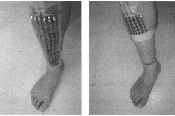 Figure  3-1:  (Left)  Tekscan  I-Scan  Model  9801  sensor  on  calf.  The  sensor  has  been cut  into  six  strips  (labelled  1-6)  to  improve  conformity  to  the  curved  leg  surface.