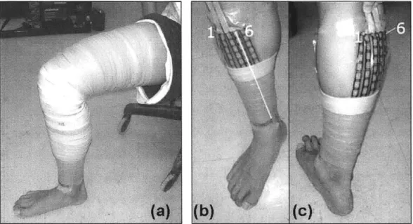 Figure  4-1:  (a)  Subject  wearing  detached  bands  prototype  from  ankle  to  thigh