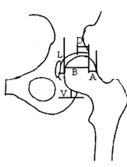 Figure  2.3: Radiographic  parameters  on hemi-pelvis.