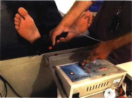 Figure  3-4:  The  ThesioWIN  being  used  to  test  a  patient  for  neuropathy.  The  The- The-sioWIN's  mechanical  workings  are  the  same  as  that  of  the  Biothesiometer  USA,  but it  includes  a  digital  readout  and  optional  computer  connec