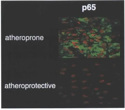 Figure  1.13: Atheroprone regions are predisposed to inflammation.