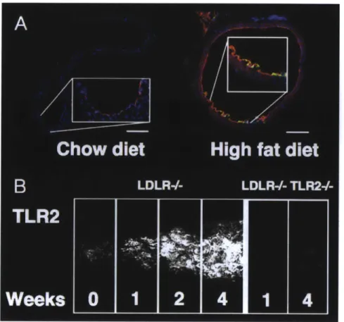 Figure  1.14:  Toll-like  receptor-2  is  expressed  in  atheroprone  regions  of  the mouse  aorta and augmented by high fat diet